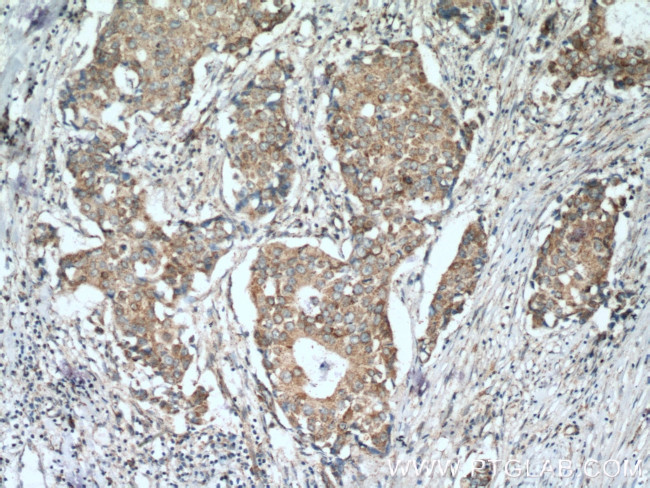 P5CS Antibody in Immunohistochemistry (Paraffin) (IHC (P))
