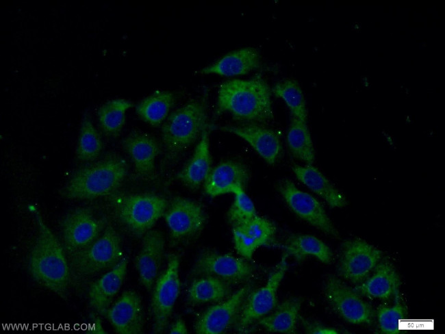 CSK Antibody in Immunocytochemistry (ICC/IF)