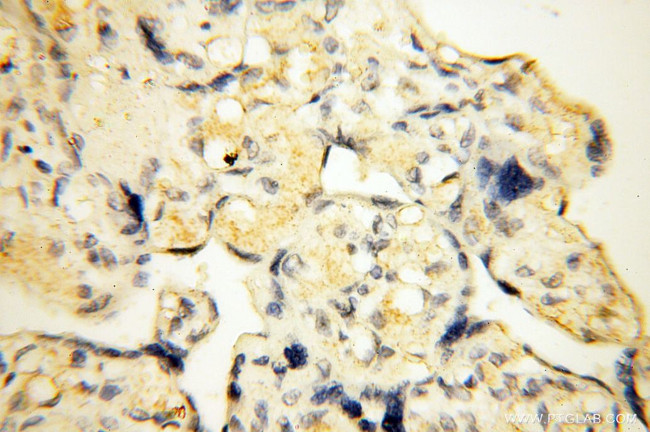 SMARCC1 Antibody in Immunohistochemistry (Paraffin) (IHC (P))