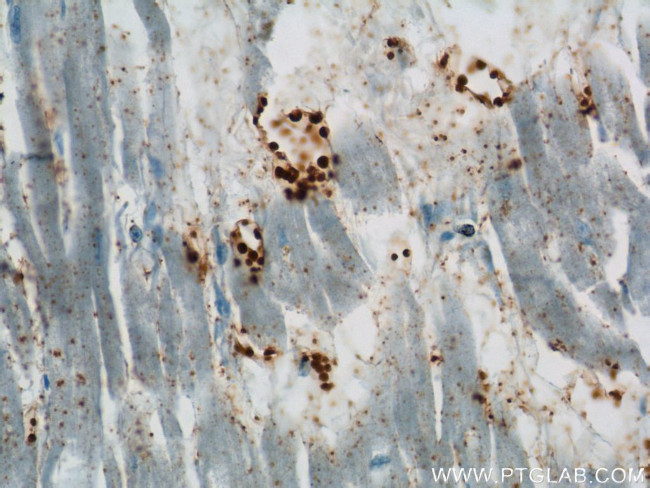BLVRB Antibody in Immunohistochemistry (Paraffin) (IHC (P))