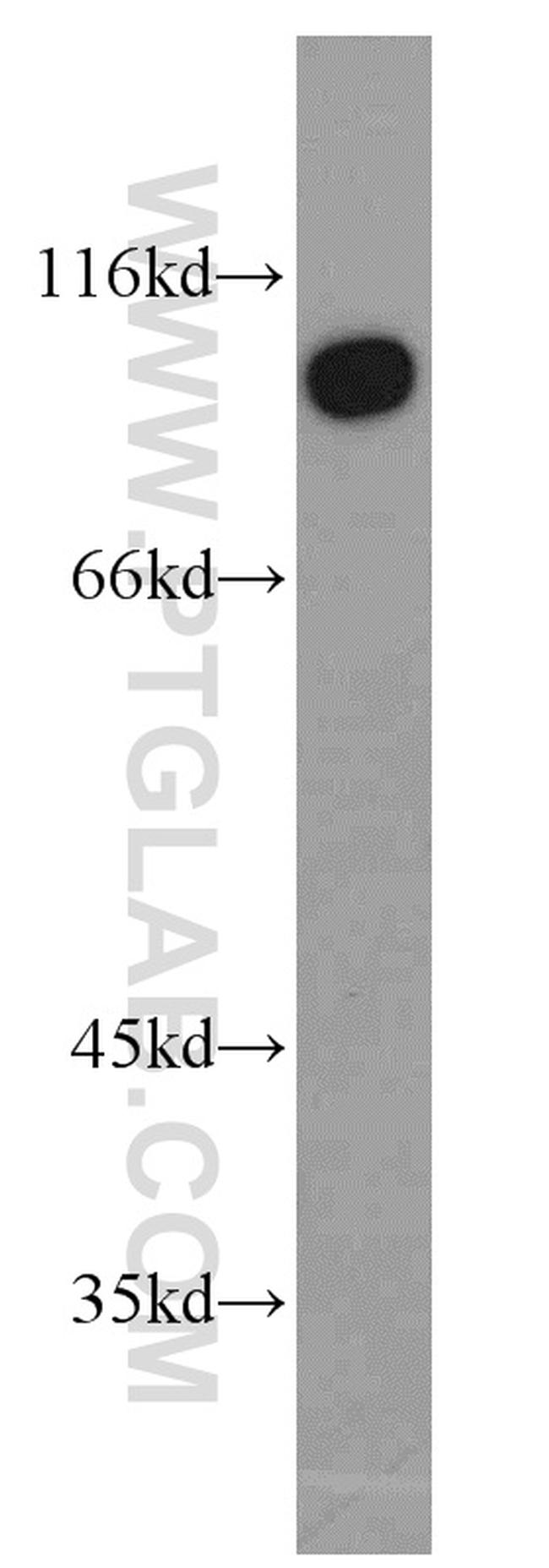 TJAP1 Antibody in Western Blot (WB)