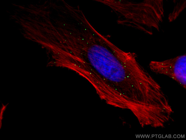 EDC4 Antibody in Immunocytochemistry (ICC/IF)