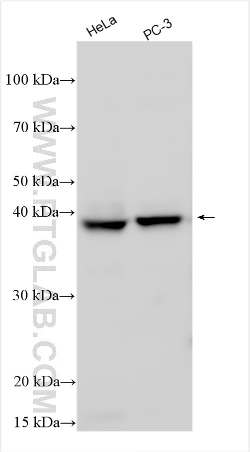 SPOPL Antibody in Western Blot (WB)
