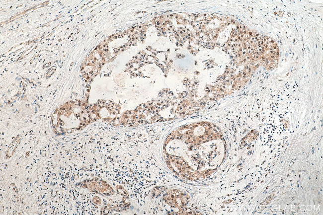 DSN1 Antibody in Immunohistochemistry (Paraffin) (IHC (P))