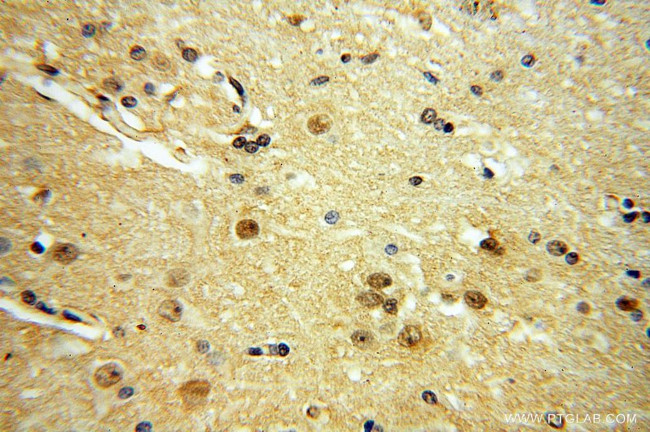 YPEL1 Antibody in Immunohistochemistry (Paraffin) (IHC (P))