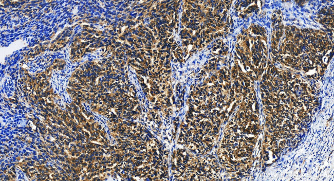 DCP2 Antibody in Immunohistochemistry (Paraffin) (IHC (P))