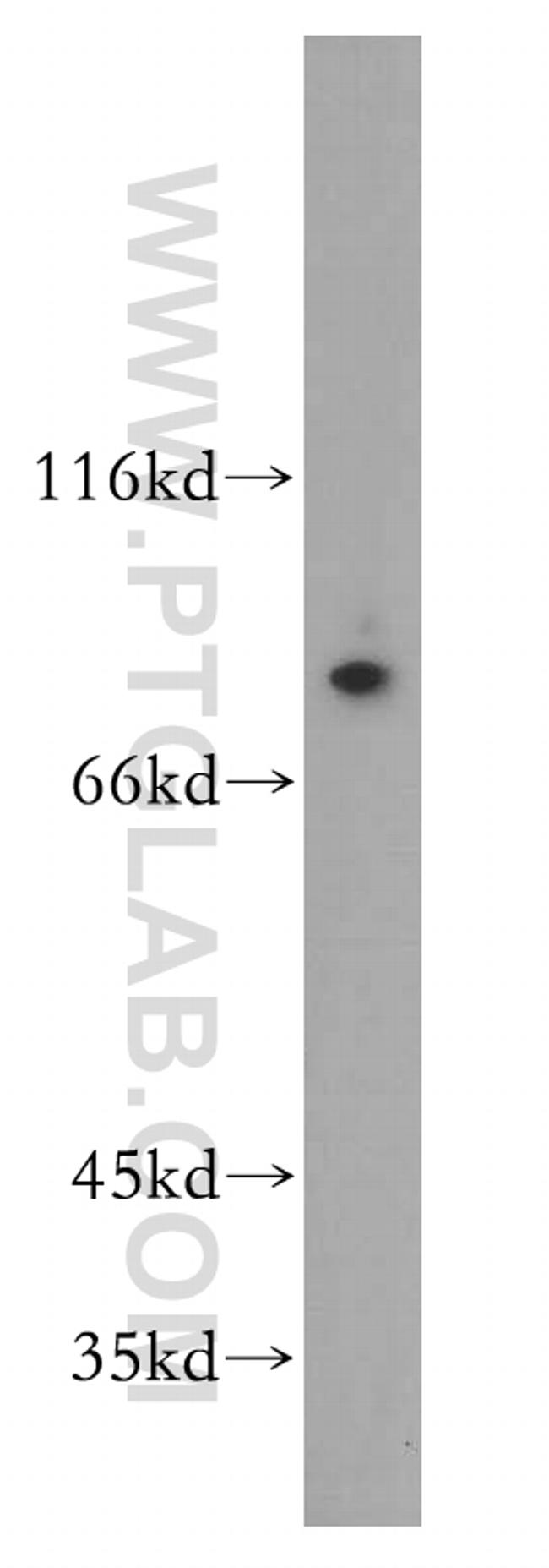 GBP4 Antibody in Western Blot (WB)