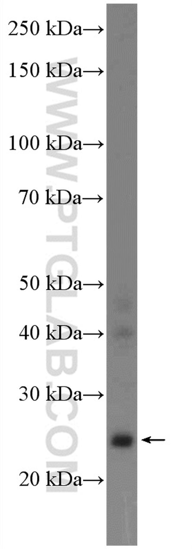 GRPEL2 Antibody in Western Blot (WB)