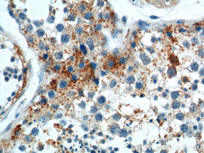 SOHLH1 Antibody in Immunohistochemistry (Paraffin) (IHC (P))