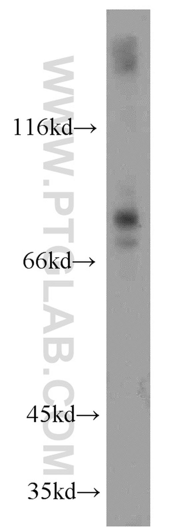SPIRE2 Antibody in Western Blot (WB)