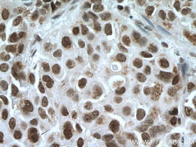 CDYL Antibody in Immunohistochemistry (Paraffin) (IHC (P))