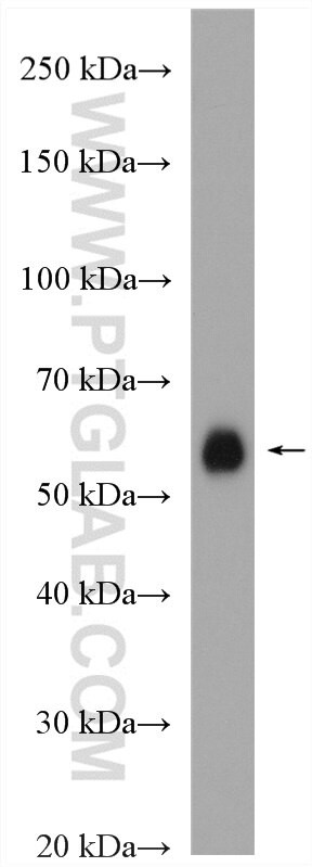 NOX1 Antibody in Western Blot (WB)