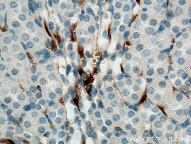 GPR126 Antibody in Immunohistochemistry (Paraffin) (IHC (P))
