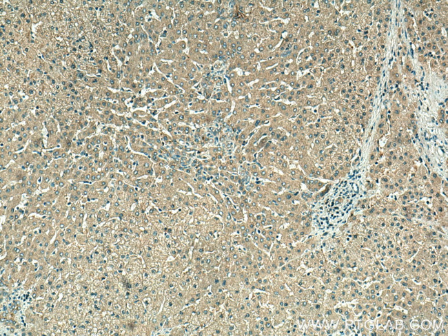 VPS16 Antibody in Immunohistochemistry (Paraffin) (IHC (P))