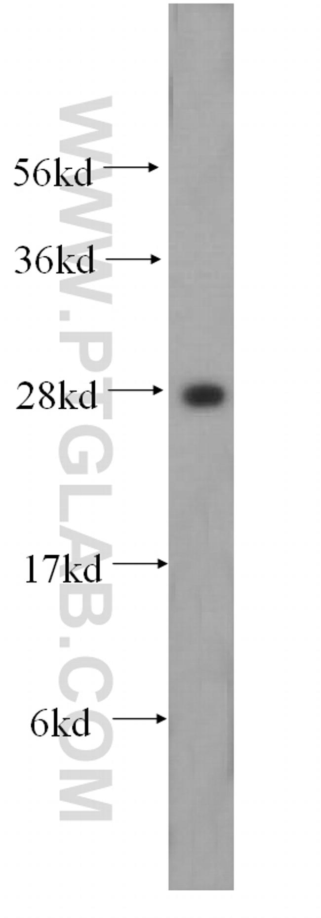 HOXD4 Antibody in Western Blot (WB)