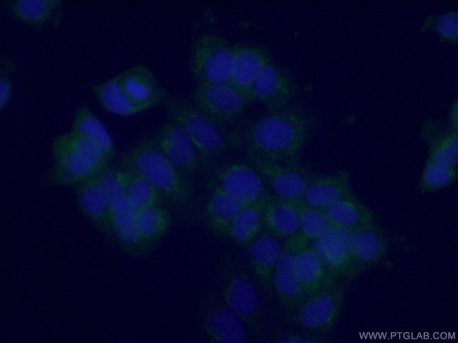 RIC8B Antibody in Immunocytochemistry (ICC/IF)
