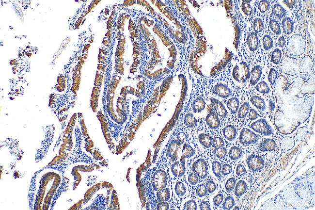 LCN15 Antibody in Immunohistochemistry (Paraffin) (IHC (P))
