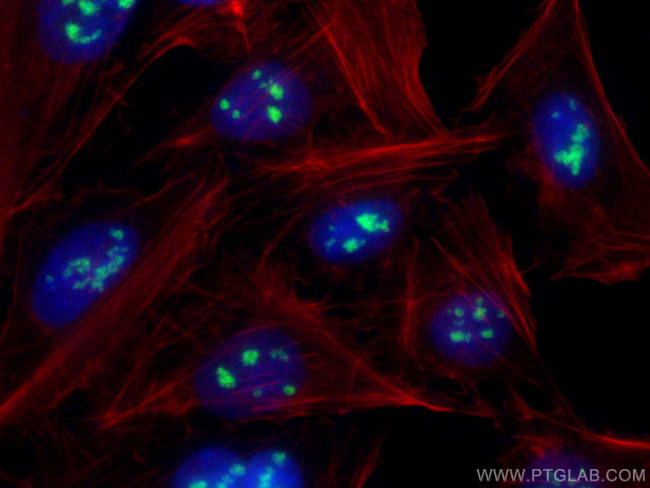 DDX47 Antibody in Immunocytochemistry (ICC/IF)
