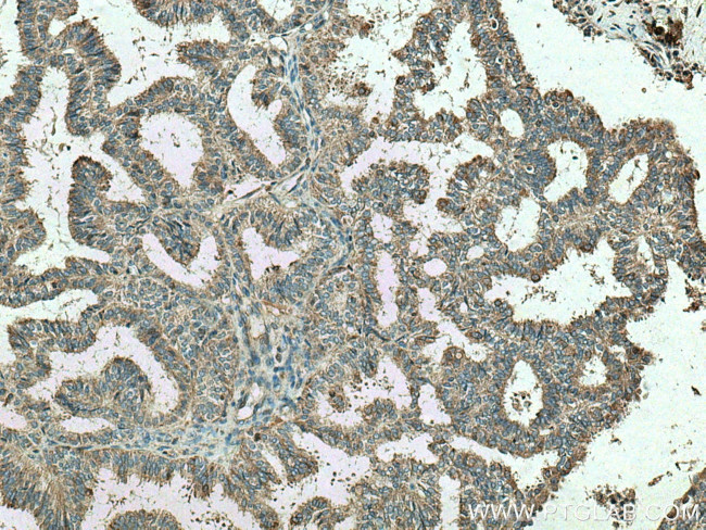 VCPIP1 Antibody in Immunohistochemistry (Paraffin) (IHC (P))
