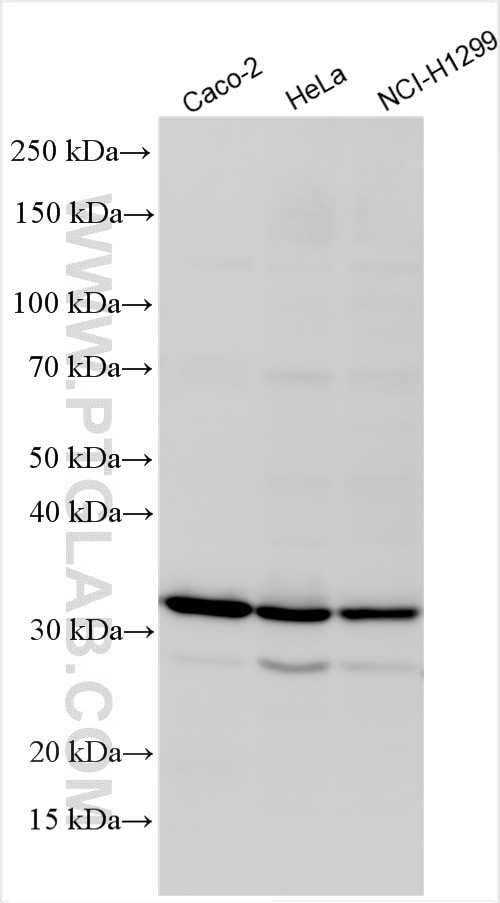 ALKBH2 Antibody in Western Blot (WB)