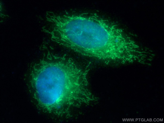COQ10A Antibody in Immunocytochemistry (ICC/IF)