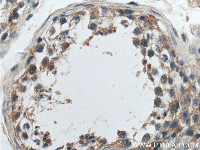 SAPS1 Antibody in Immunohistochemistry (Paraffin) (IHC (P))