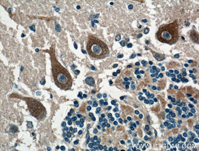 CACNA1G Antibody in Immunohistochemistry (Paraffin) (IHC (P))