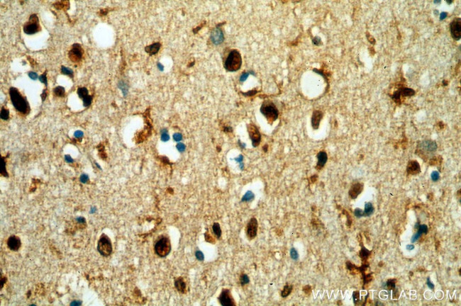 TCEA1 Antibody in Immunohistochemistry (Paraffin) (IHC (P))