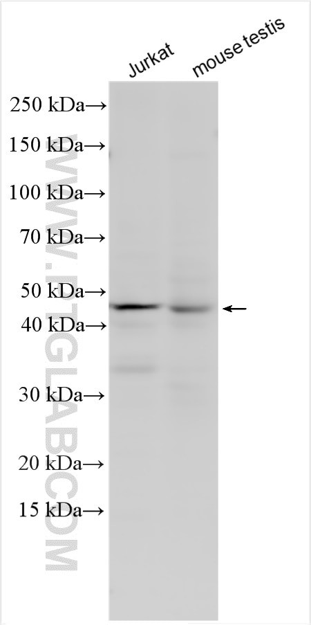 SLC35E2B Antibody in Western Blot (WB)