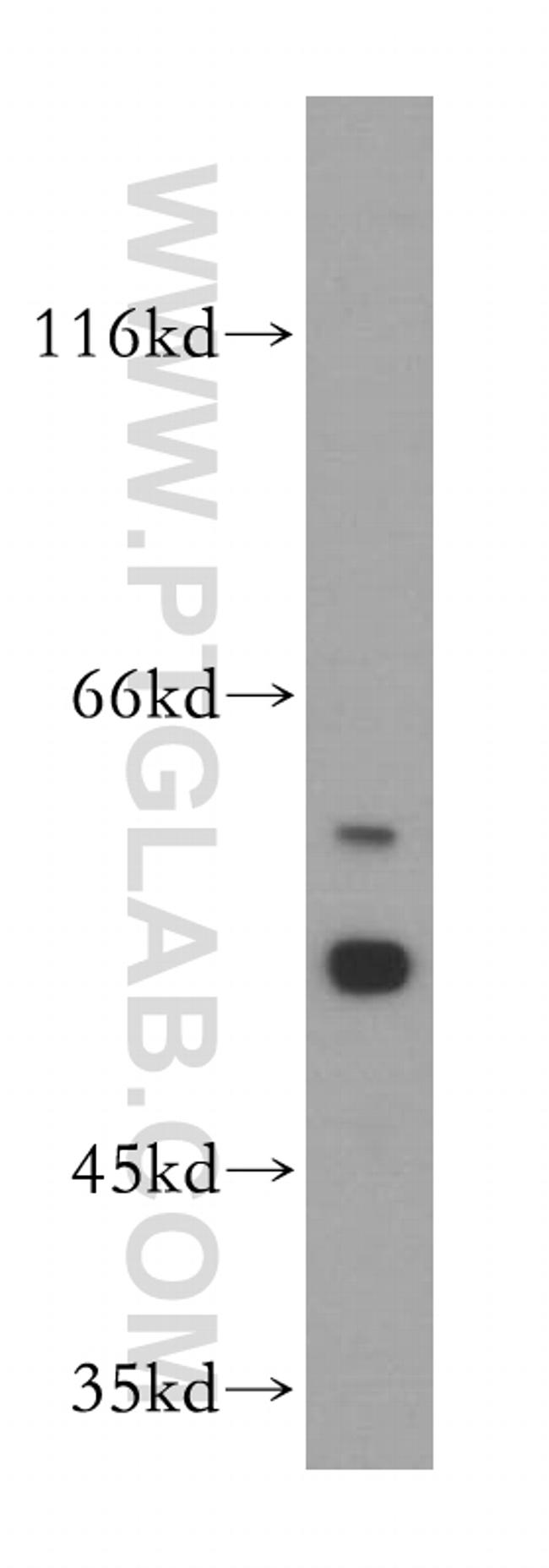 MGAT4C Antibody in Western Blot (WB)