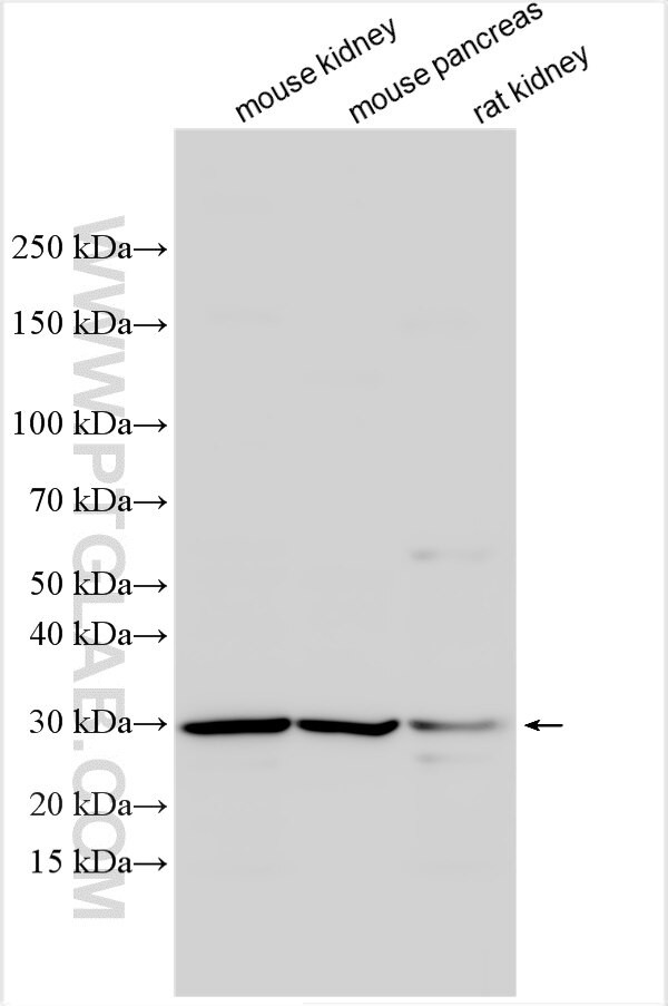BDKRB2 Antibody in Western Blot (WB)