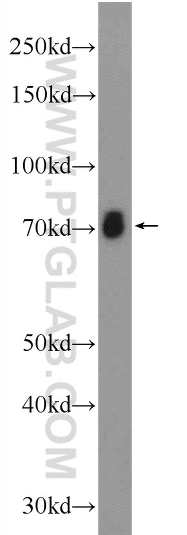 ASIC2 Antibody in Western Blot (WB)