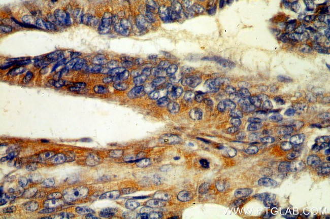 MGAT3 Antibody in Immunohistochemistry (Paraffin) (IHC (P))