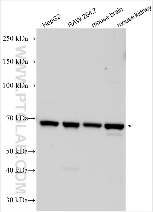 SLC6A18 Antibody in Western Blot (WB)