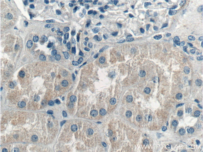 LMAN2L Antibody in Immunohistochemistry (Paraffin) (IHC (P))