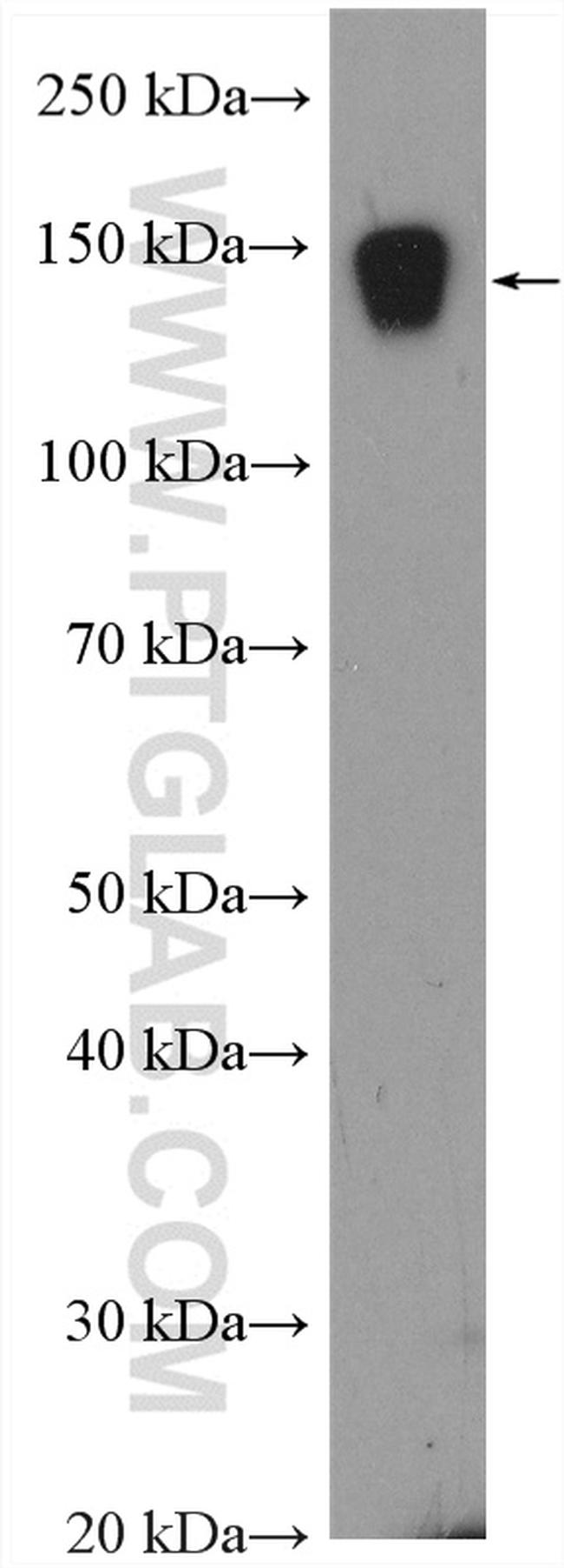 MMRN1 Antibody in Western Blot (WB)