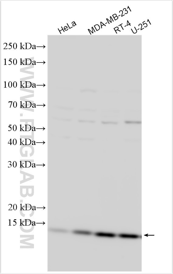 NDUFA11 Antibody in Western Blot (WB)