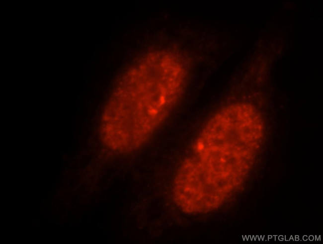 SLTM Antibody in Immunocytochemistry (ICC/IF)