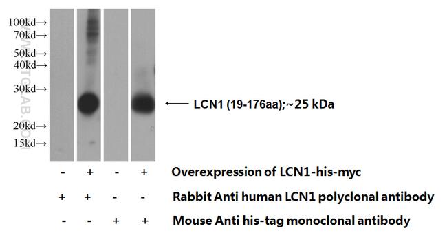 LCN1 Antibody in Western Blot (WB)