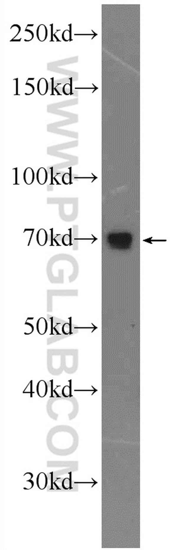 AP1G2 Antibody in Western Blot (WB)