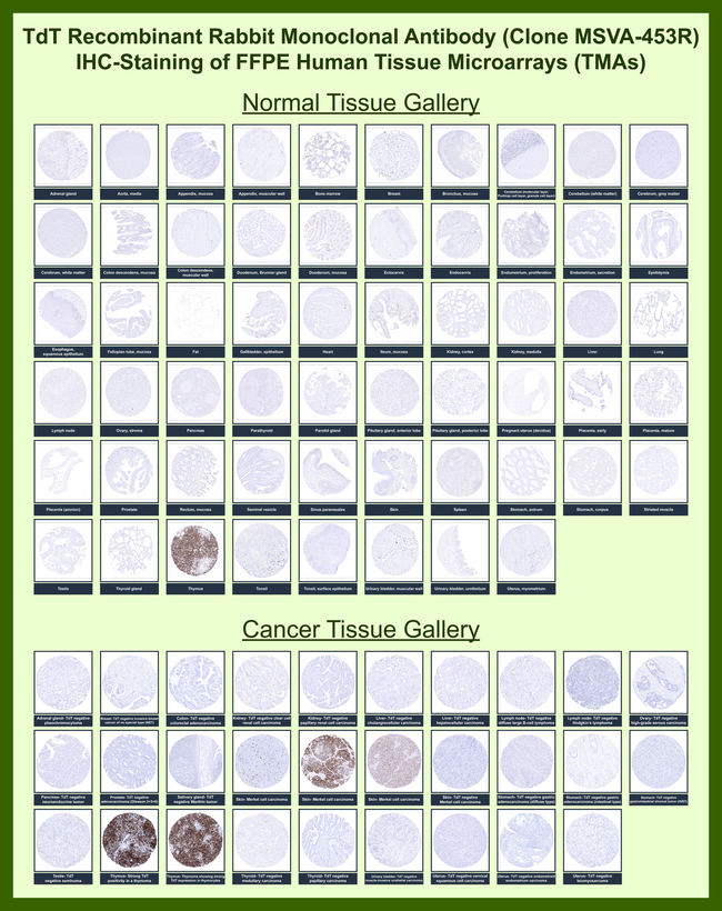 TdT/DNA Nucleotidylexotransferase (Acute Lymphoblastic Leukemia Marker) Antibody in Immunohistochemistry (Paraffin) (IHC (P))