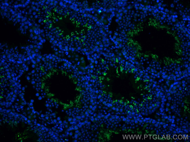 PLAC9 Antibody in Immunohistochemistry (PFA fixed) (IHC (PFA))
