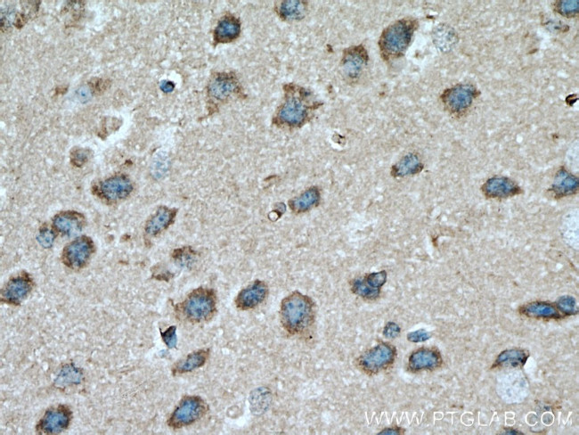 ADPRH Antibody in Immunohistochemistry (Paraffin) (IHC (P))