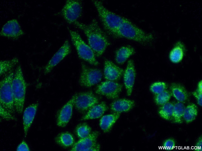 SEC31A Antibody in Immunocytochemistry (ICC/IF)