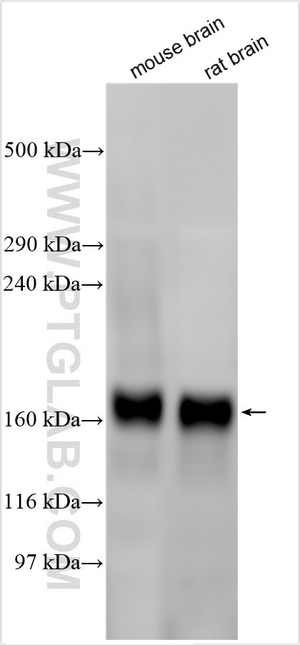 PCDH17 Antibody in Western Blot (WB)