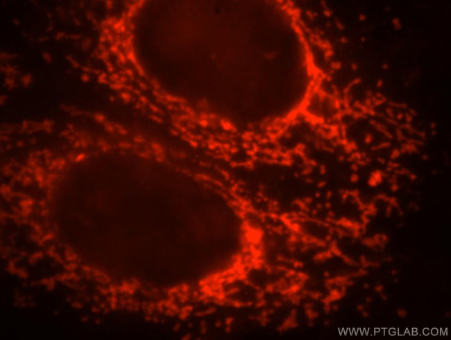 ETFB Antibody in Immunocytochemistry (ICC/IF)