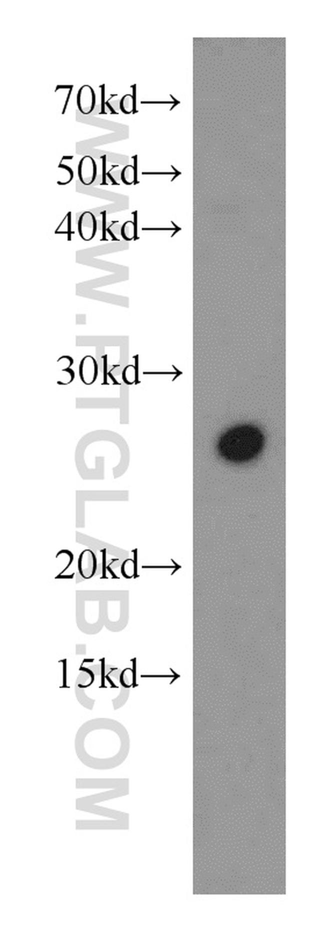 SFRS9 Antibody in Western Blot (WB)