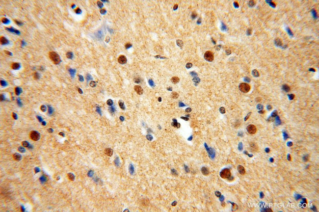 TUB Antibody in Immunohistochemistry (Paraffin) (IHC (P))