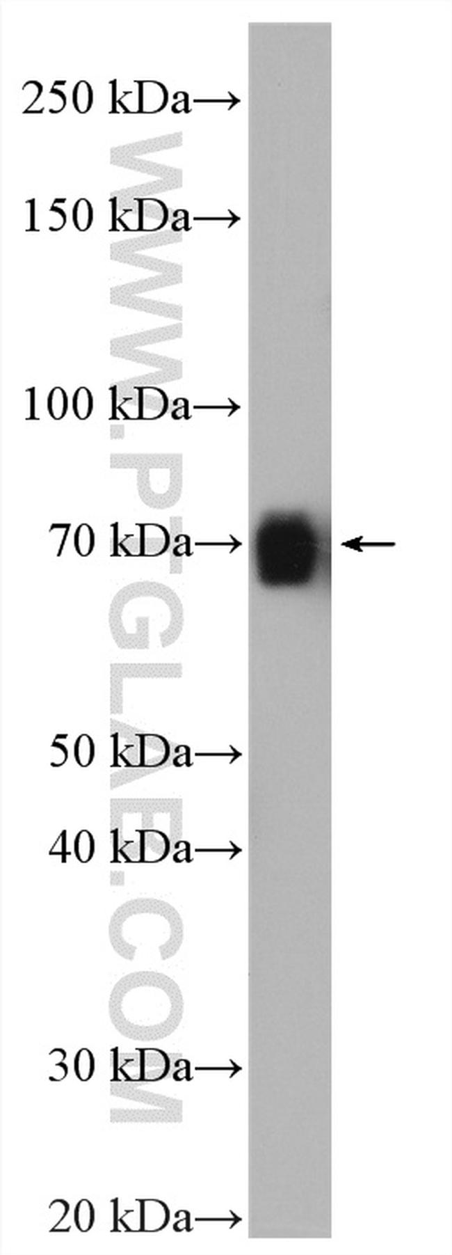 KCNN1 Antibody in Western Blot (WB)