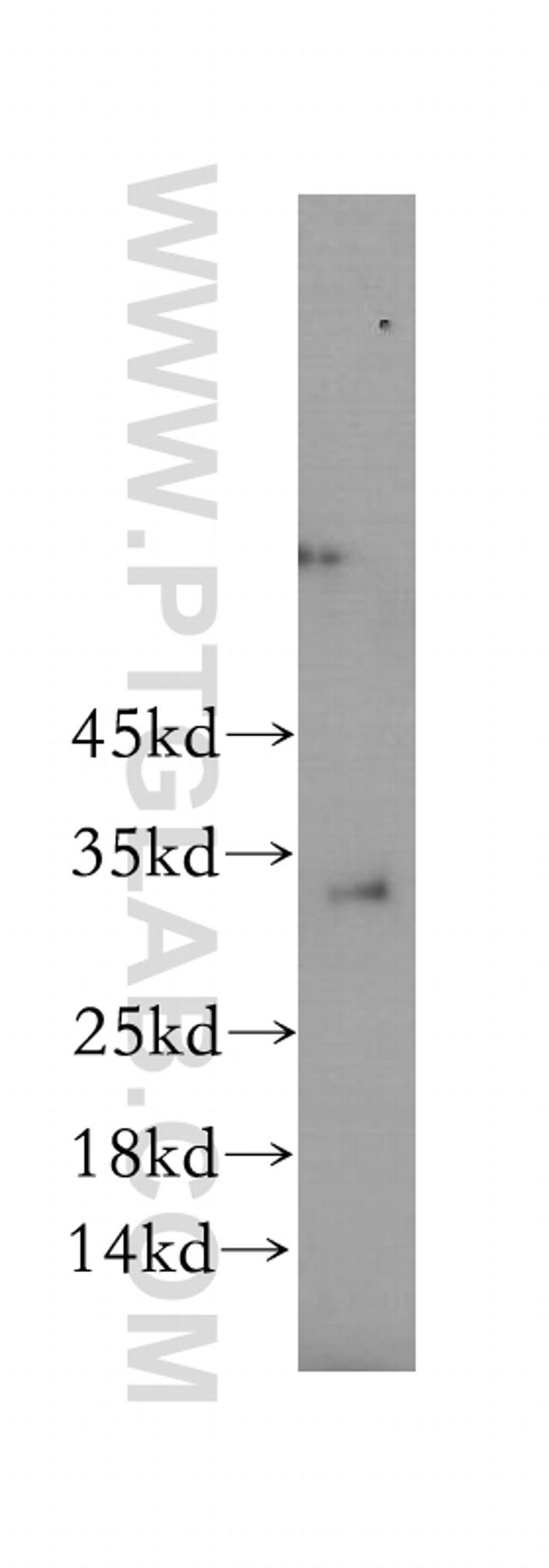 SPRY3 Antibody in Western Blot (WB)